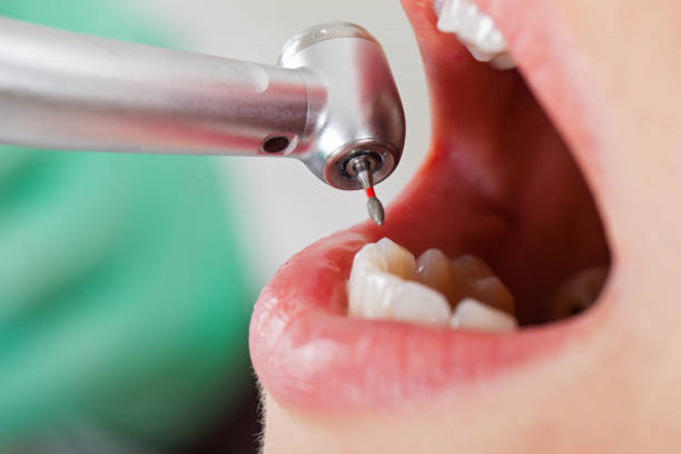Best Pediatric Emergency Dentist in Helena Valley Northeast, MT